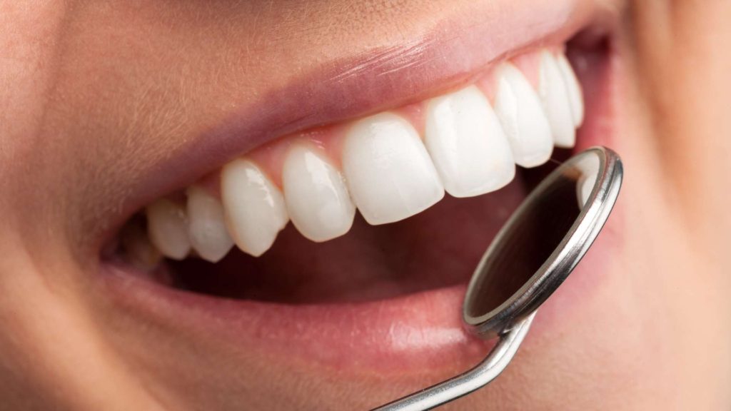 5 Popular Cosmetic Dentistry Treatments